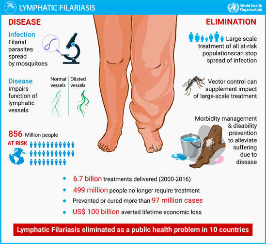 Lymphatic-filariasis-infographic