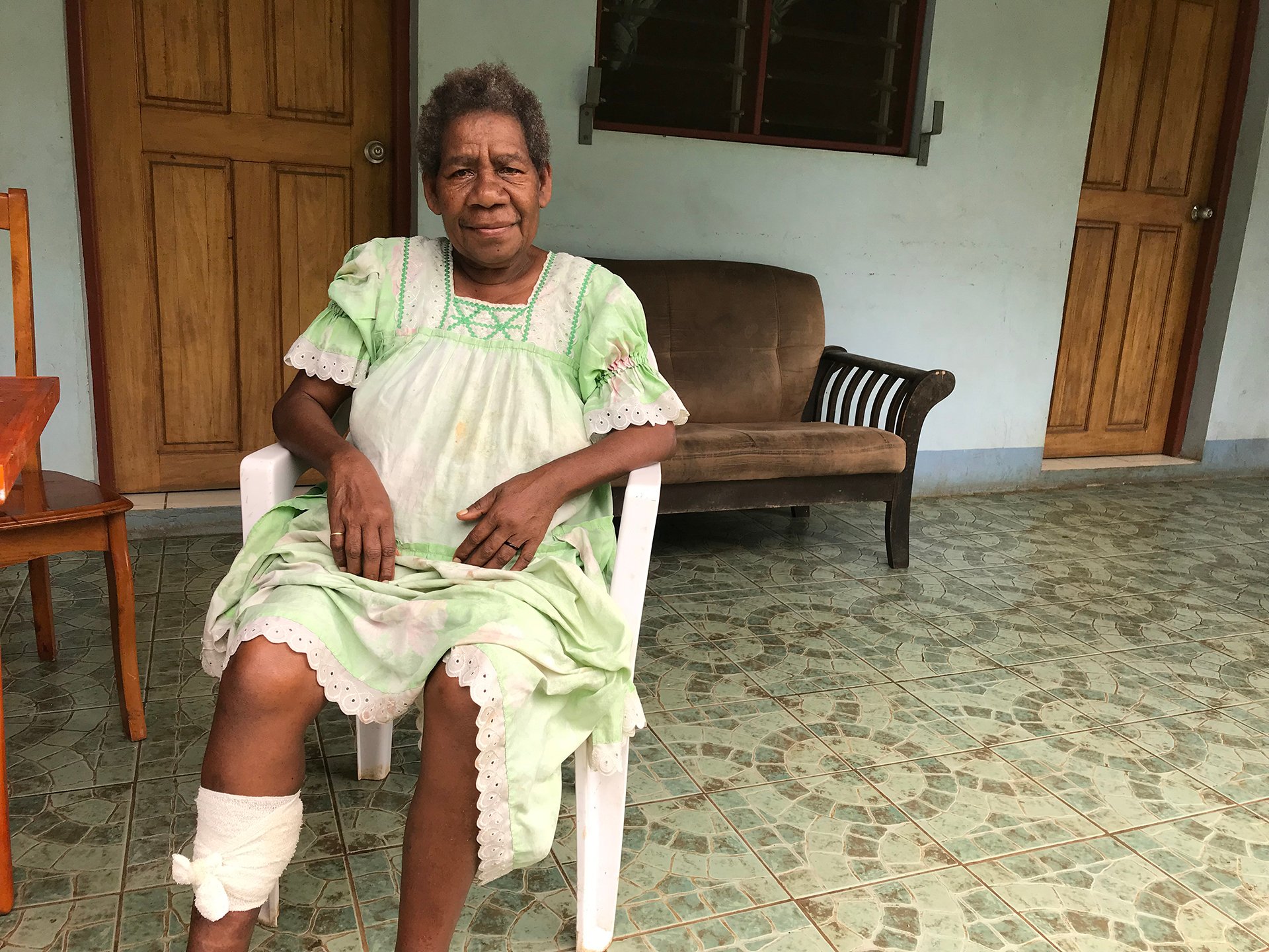 A Vanatu, une femme atteinte de diabète avec une jambe bandée est assise 